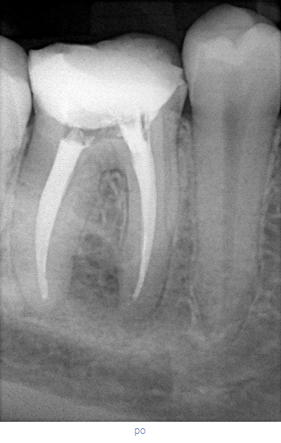 endodoncja