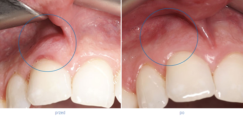 Periodontologia