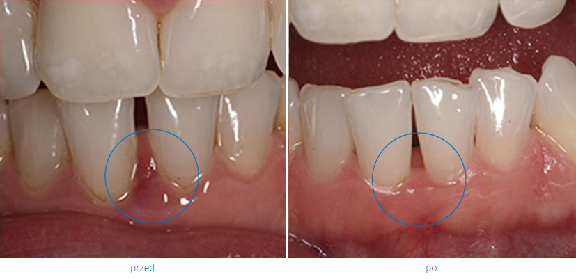 Periodontologia